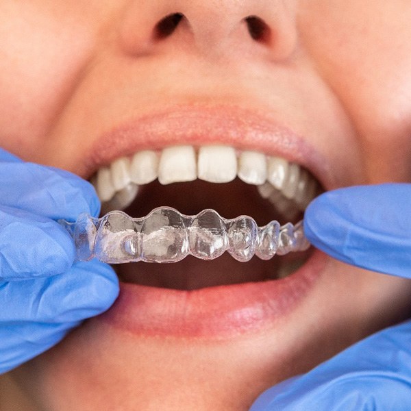 Woman getting Invisalign
